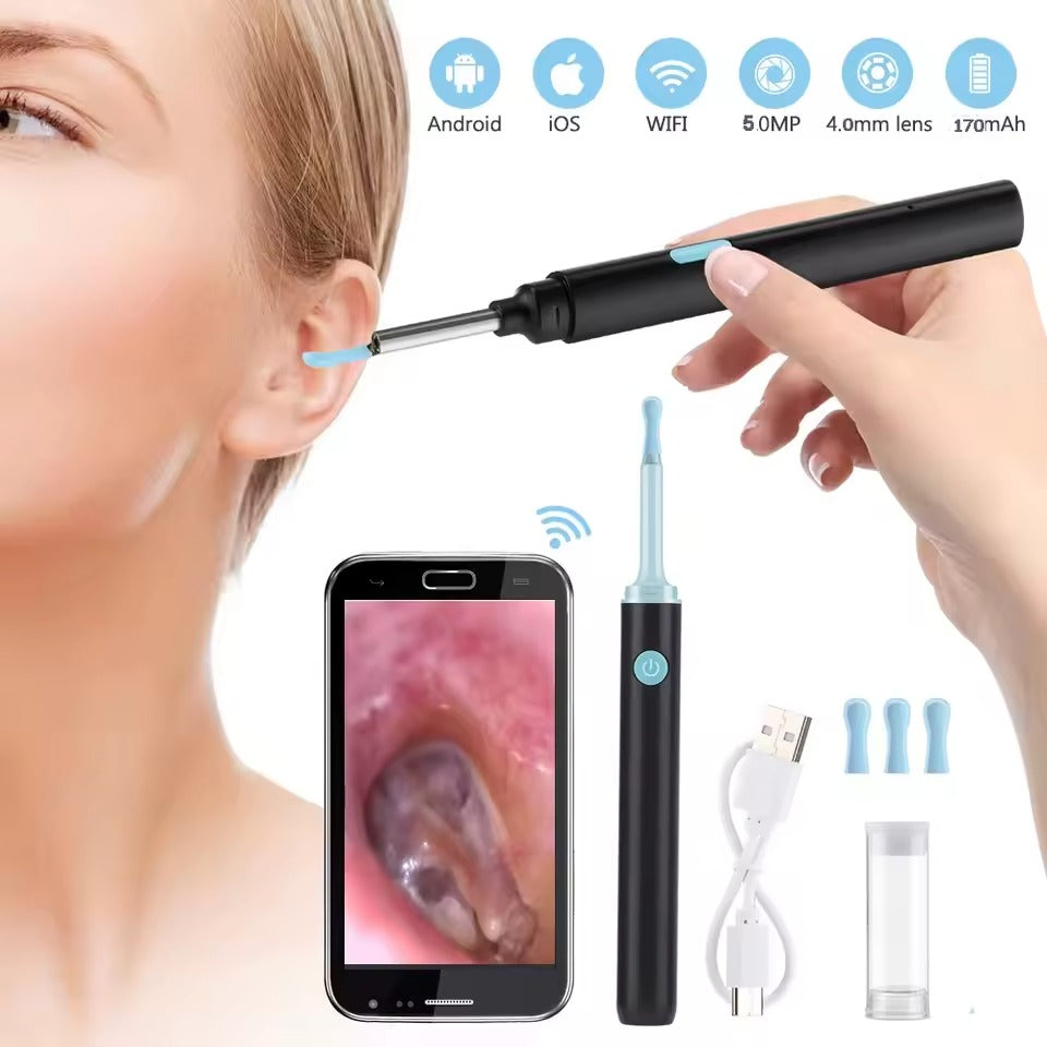 Wireless HD Otoscope - Advanced Ear Examination & Cleaning Tool