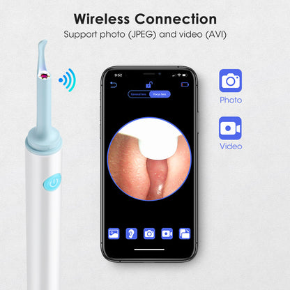Wireless HD Otoscope - Advanced Ear Examination & Cleaning Tool